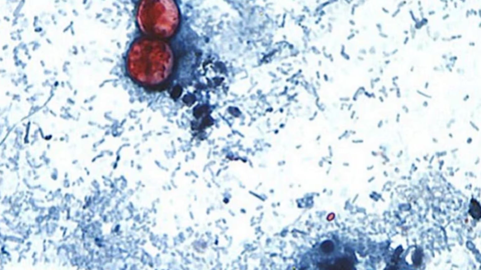 Ciclosporíase: Entenda o parasita que preocupa os EUA