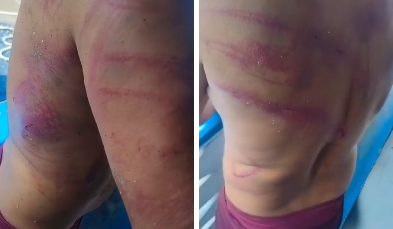 Trabalhador é agredido por piratas dos rios em Jutaí, AM