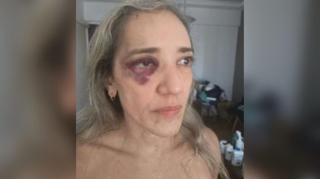 Passageira é agredida por motociclista de aplicativo após reclamar de capacete