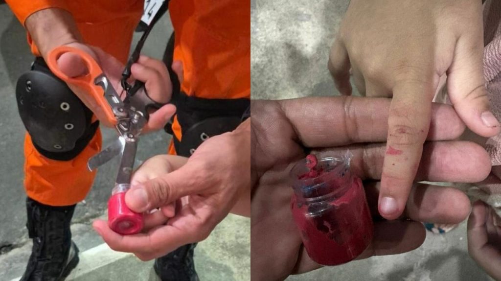 Criança fica com dedo preso em pote de massinha em Manaus