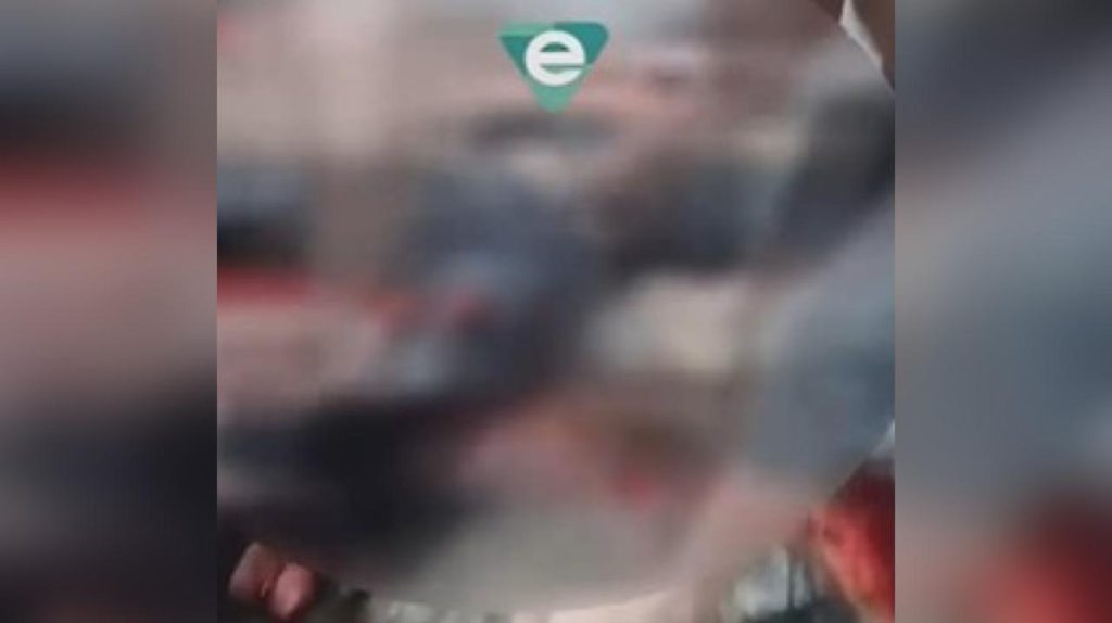 Motociclista sofre grave acidente e tem perna esmagada em Manaus