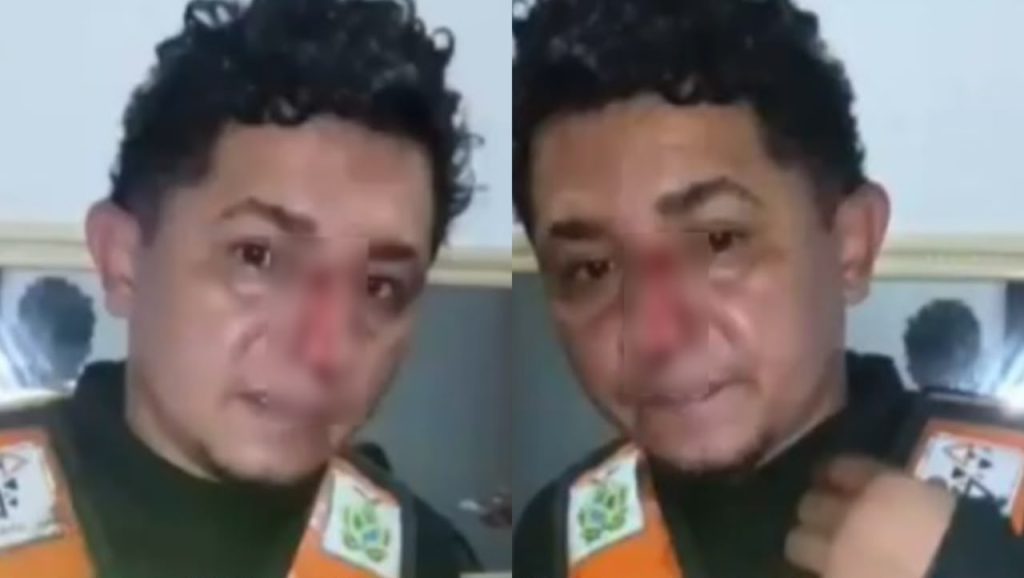 Mototaxista sofre corte profundo no rosto por linha de papagaio em Tefé